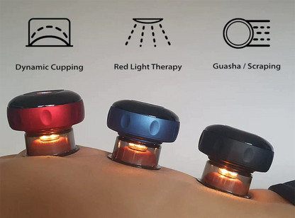 SmartCup Electric Cupping